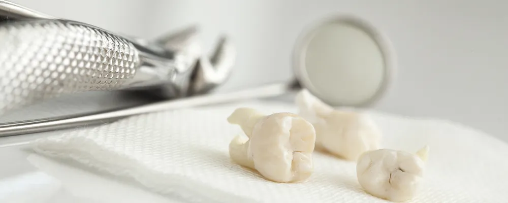 他院で敬遠される「親知らず」の難抜歯に対応